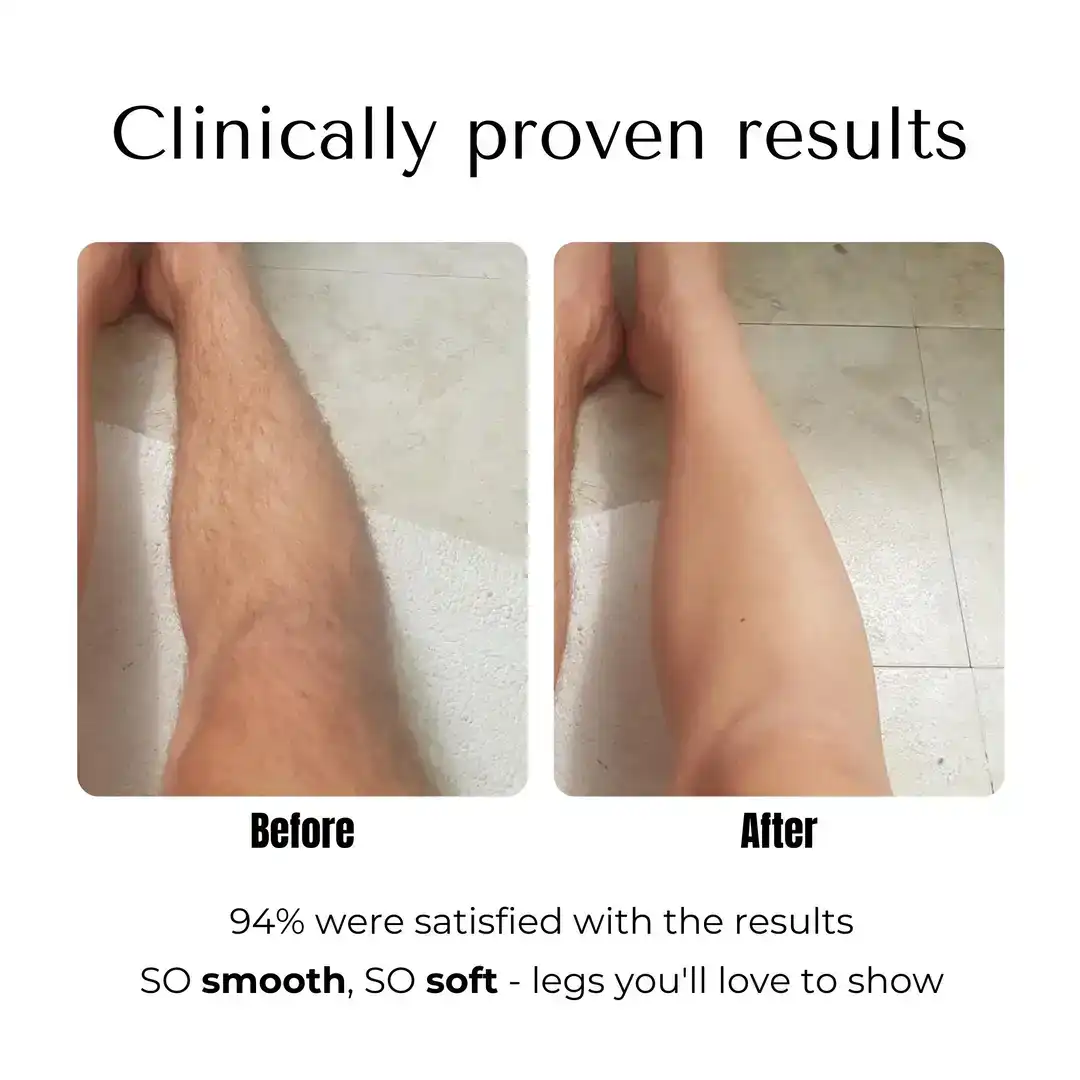 thumb image